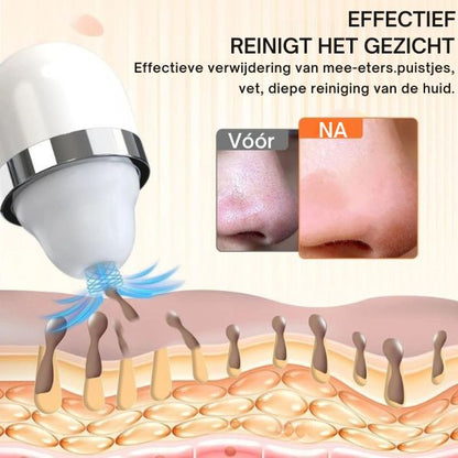 BlackheadBlitz – Verwijder mee-eters met zachte zuiging