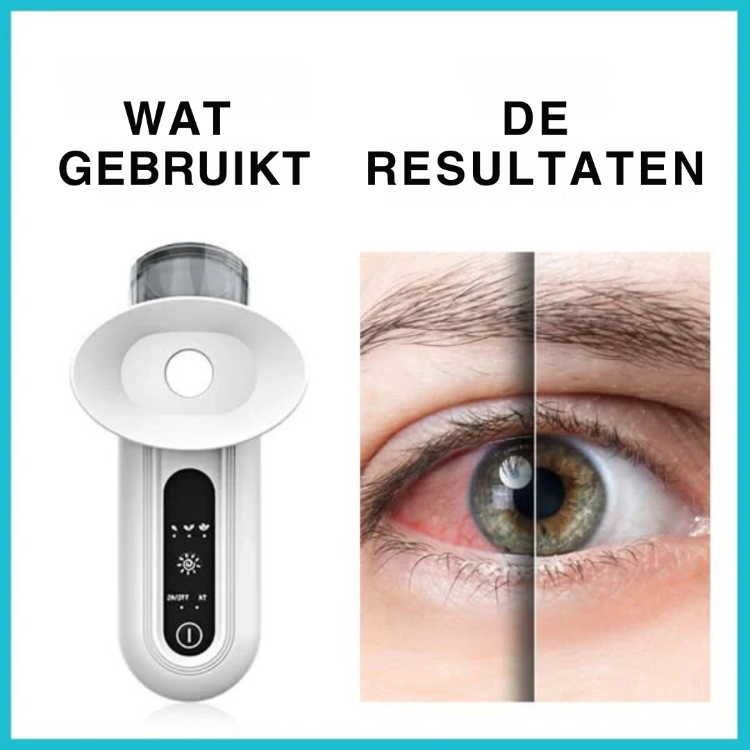 MistRelief | Kalmerende stoomtherapie voor de ogen