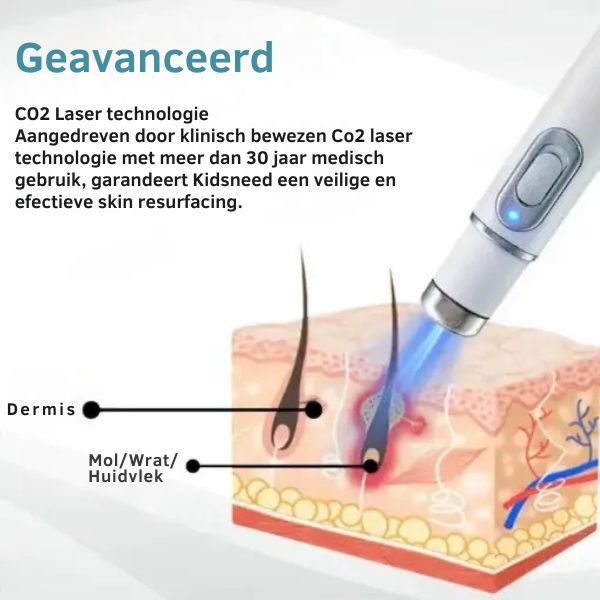 Silk Laser - Precisie en zachtheid in één
